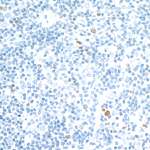 c-Maf Antibody in Immunohistochemistry (Paraffin) (IHC (P))