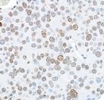 gamma-H2AX Antibody in Immunohistochemistry (Paraffin) (IHC (P))