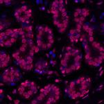 gamma-H2AX Antibody in Immunohistochemistry (Paraffin) (IHC (P))