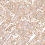 Cytoskeletal Actin Antibody in Immunohistochemistry (Paraffin) (IHC (P))