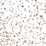 NAMPT/PBEF/Visfatin Antibody in Immunocytochemistry (ICC/IF)