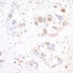 NAMPT/PBEF/Visfatin Antibody in Immunohistochemistry (Paraffin) (IHC (P))