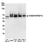 HVEM/TNFRSF14 Antibody in Western Blot (WB)