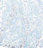 DNAM-1/CD226 Antibody in Immunohistochemistry (Paraffin) (IHC (P))