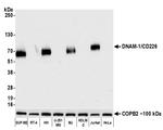 DNAM-1/CD226 Antibody in Western Blot (WB)