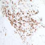 DNAM-1/CD226 Antibody in Immunohistochemistry (Paraffin) (IHC (P))