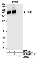 CD96 Antibody in Immunoprecipitation (IP)