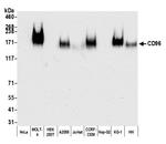 CD96 Antibody in Western Blot (WB)