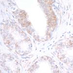 Nectin-2/CD112 Antibody in Immunohistochemistry (Paraffin) (IHC (P))