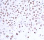 USP7/HAUSP Antibody in Immunohistochemistry (Paraffin) (IHC (P))