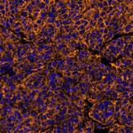 PVR/CD155 Antibody in Immunohistochemistry (Paraffin) (IHC (P))