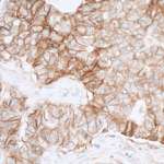 PVR/CD155 Antibody in Immunohistochemistry (Paraffin) (IHC (P))