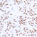 SOX10 Antibody in Immunohistochemistry (Paraffin) (IHC (P))