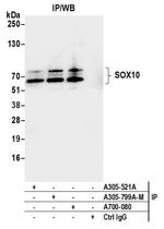 SOX10 Antibody in Immunoprecipitation (IP)