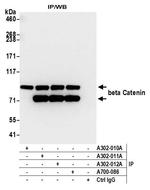 beta Catenin Antibody in Immunoprecipitation (IP)