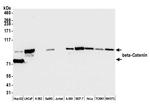 beta Catenin Antibody in Western Blot (WB)