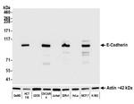 E-Cadherin Antibody in Western Blot (WB)