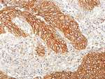 E-Cadherin Antibody in Immunohistochemistry (Paraffin) (IHC (P))