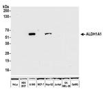 ALDH1A1 Antibody in Western Blot (WB)