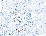 TJP1/ZO-1 Antibody in Immunohistochemistry (Paraffin) (IHC (P))