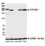 TJP1/ZO-1 Antibody in Western Blot (WB)