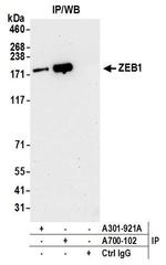 ZEB1 Antibody in Immunoprecipitation (IP)