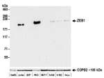 ZEB1 Antibody in Western Blot (WB)