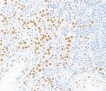 MLH1 Antibody in Immunohistochemistry (Paraffin) (IHC (P))