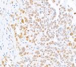 MLH1 Antibody in Immunohistochemistry (Paraffin) (IHC (P))