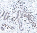 GATA3 Antibody in Immunohistochemistry (Paraffin) (IHC (P))