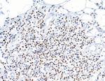 RUNX3 Antibody in Immunohistochemistry (Paraffin) (IHC (P))