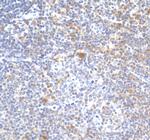STAT5a Antibody in Immunohistochemistry (Paraffin) (IHC (P))