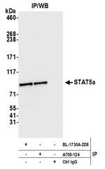 STAT5a Antibody in Immunoprecipitation (IP)
