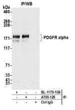 PDGFR alpha Antibody in Immunoprecipitation (IP)