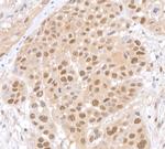 Lasu1/Ureb1 Antibody in Immunohistochemistry (Paraffin) (IHC (P))