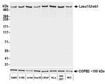 Lasu1/Ureb1 Antibody in Western Blot (WB)