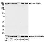 Lasu1/Ureb1 Antibody in Western Blot (WB)