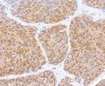 SMAD2 Antibody in Immunohistochemistry (Paraffin) (IHC (P))