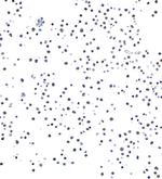 SMAD4 Antibody in Immunocytochemistry (ICC/IF)