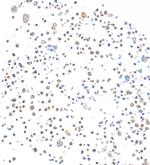 SMAD4 Antibody in Immunocytochemistry (ICC/IF)