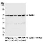 SMAD4 Antibody in Western Blot (WB)