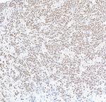 FOXP1 Antibody in Immunohistochemistry (Paraffin) (IHC (P))