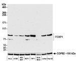 FOXP1 Antibody in Western Blot (WB)