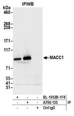 MACC1 Antibody in Immunoprecipitation (IP)