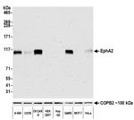 EphA2 Antibody in Western Blot (WB)