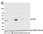 Slug Antibody in Western Blot (WB)