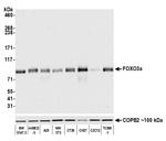 FOXO3a Antibody in Western Blot (WB)