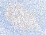 Bcl6 Antibody in Immunohistochemistry (Paraffin) (IHC (P))