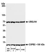 UBQLN4/CIP75/Ubiquilin 4 Antibody in Western Blot (WB)