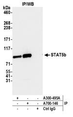 STAT5b Antibody in Immunoprecipitation (IP)